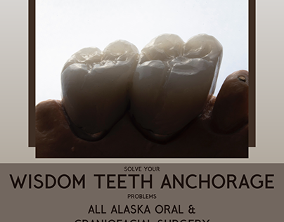 Solve your Wisdom Teeth Anchorage problems