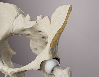 3D Cross Section of A Bone
