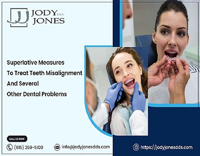 Superlative Measures To Treat Teeth Misalignment