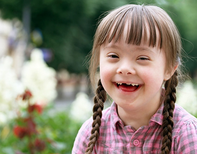 Down syndrome is one of the congenital diseases