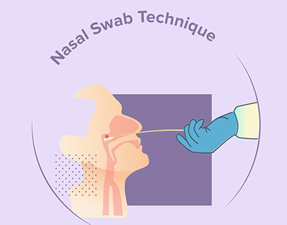 Nasal Swab- Medical Explainer