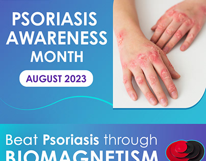 Elevating Psoriasis Awareness in August: Biomagnetism