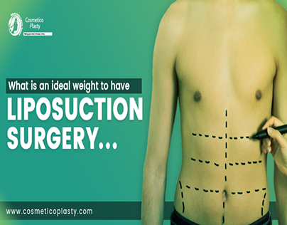 What is an Ideal Weight to have Liposuction Surgery
