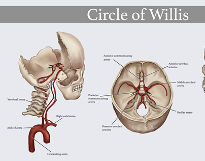 Circle of Willis