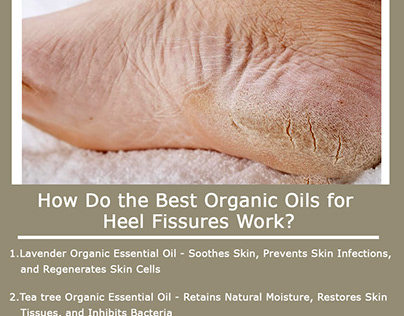 The Best Organic Essential Oils for Heel Fissures