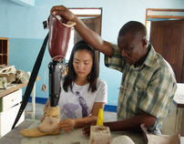 Designing Prosthesis in Tanzania