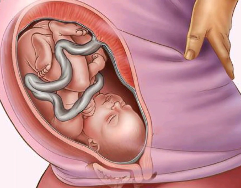 Manzanilla embarazo 35 semanas