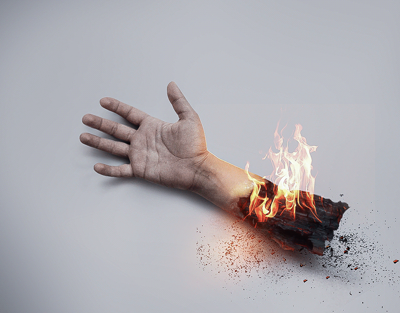 Burning hand Art. Sign you might Burn your hands. Burned hand