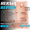 Hernia Surgeon's profile